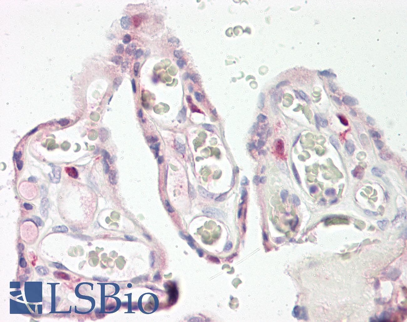 KERA / Keratocan Antibody (aa196-245)