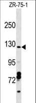 CCDC132 Antibody (aa904-930)