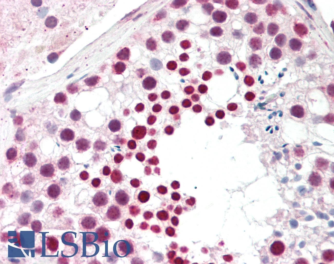 CTAG1B / NY-ESO-1 Antibody (C-Terminus)