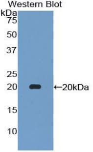 CSF2RA / CD116 Antibody (aa204-360)