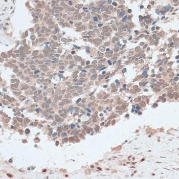 Polyclonal Rabbit anti-Human ZNF562 Antibody (IHC)
