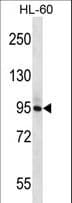 PLCD1 Antibody (aa134-163)