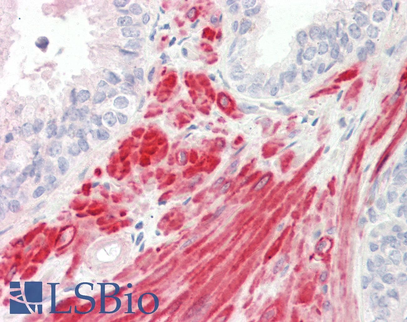 RSPRY1 Antibody (aa74-123)