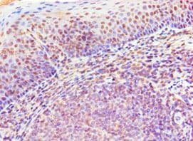 CD20 Antibody (aa208-297)