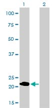 MLC3F / MYL1 Antibody (clone 2D9)