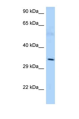 Polyclonal Rabbit anti-Human AMD / AMD1 Antibody (aa242-291, WB)
