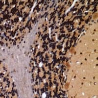 Polyclonal Rabbit anti-Human FGF1 / Acidic FGF Antibody (IHC, WB)