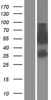 ARFGAP2 / ZNF289 Protein (Over-Expression Lysate Myc-DDK (Flag))