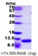 Mouse S100A8 / MRP8 Protein (Recombinant His)