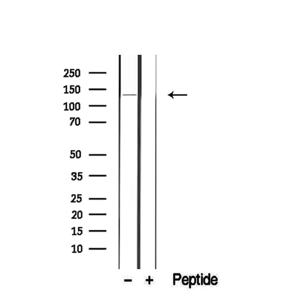Polyclonal Rabbit anti-Human ITGA6/Integrin Alpha 6/CD49f Antibody (IHC, WB)