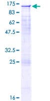 Human AXL Protein (Recombinant GST)