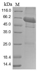 Rat PKM / Pyruvate Kinase, Muscle Protein (Recombinant 10His, N-terminus + Myc, C-terminus)
