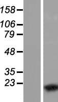 WTAP Protein (Over-Expression Lysate Myc-DDK (Flag))