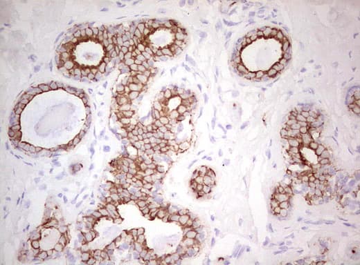 Basic Cytokeratin AE3 Antibody (clone AE3)