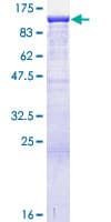 Human ANKRD17 Protein (Recombinant GST)