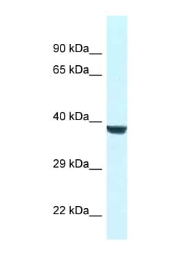 WDR45L Antibody (aa65-114)