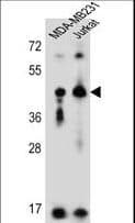 KIR2DL2 / CD158b Antibody (aa263-291)