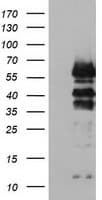 VASP Antibody (clone OTI1C3)