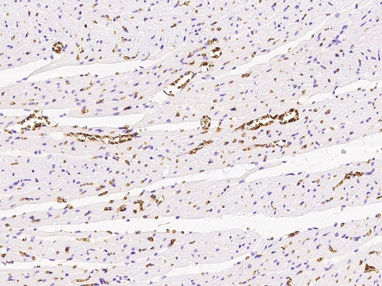 SLC4A1 / Band 3 / AE1 Antibody