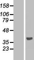 PPP1CA / PP1-Alpha Protein (Over-Expression Lysate Myc-DDK (Flag))