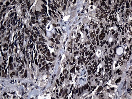 ZNF583 Antibody (clone OTI2A2, Carrier-free)
