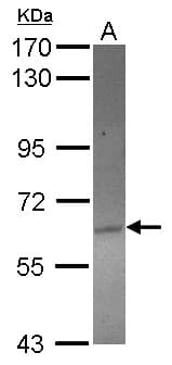 ACOT12 Antibody