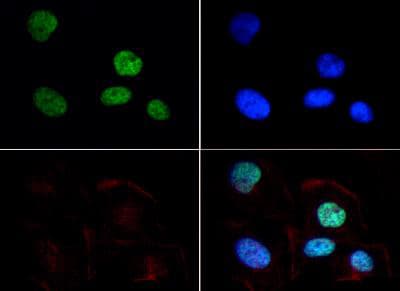 HIST3H3 Antibody (Me2-Lys9)