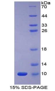 Human Apelin Protein (Recombinant His)