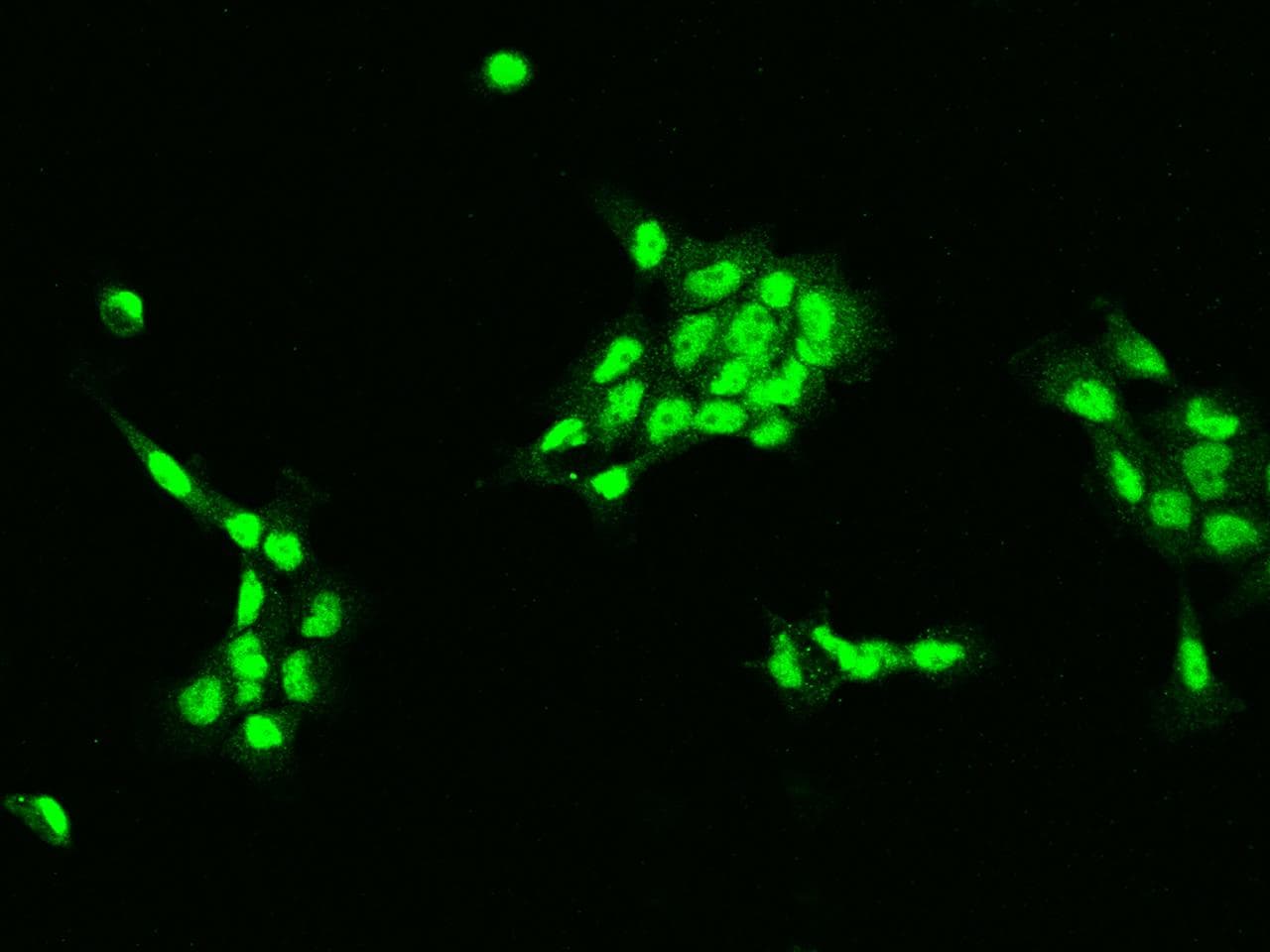 Polyclonal Rabbit anti-Human DCPS Antibody (IHC, IF)