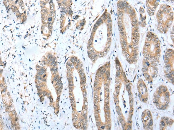 ACBD4 Antibody