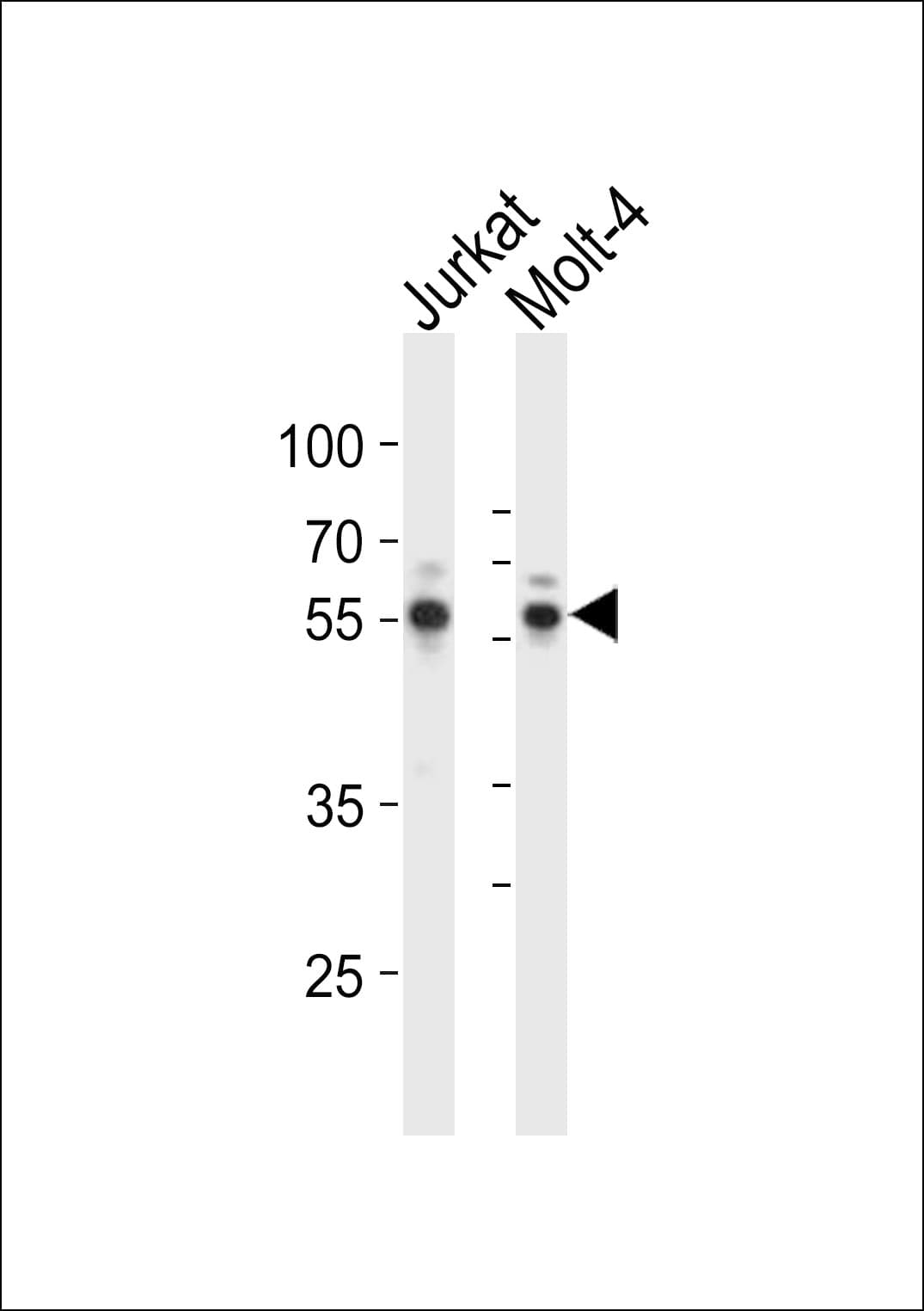 AML1 / RUNX1 Antibody (aa421-455)