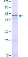 Human CDK4 Protein (Recombinant GST)