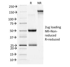 Monoclonal Mouse anti-Human CD71 / Transferrin Receptor Antibody (clone TFRC/1396, Azide-free,BSA-free, IHC, IF, WB)