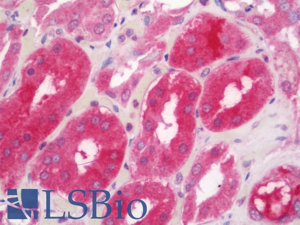 IHC-plus™ IKBKG / NEMO / IKK Gamma Antibody (aa51-100)