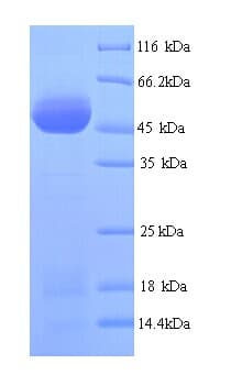 African Cassava Mosaic Virus Replication-Associated protein (Recombinant His)