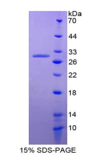 Human TMEFF2 Protein (Recombinant His-T7)
