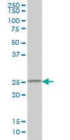 Monoclonal Mouse anti-Human CIDEB Antibody (clone 2A10, IHC, WB)