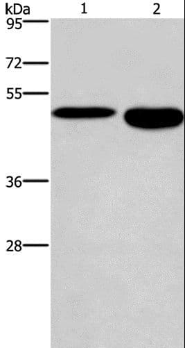 Polyclonal Rabbit anti-Human DMRTA3 / DMRT3 Antibody (IHC, WB)