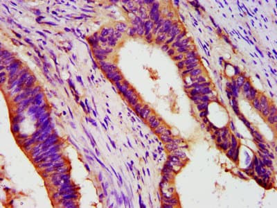 Polyclonal Rabbit anti-Human PEX26 Antibody (IHC, WB)