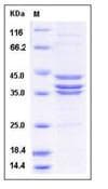 Human CDK7 + CCNH + MNAT1 Heterotrimer Protein (Recombinant His,N-terminus)