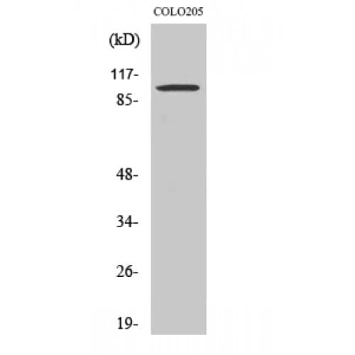 SNCAIP / Synphilin 1 Antibody (C-terminal)