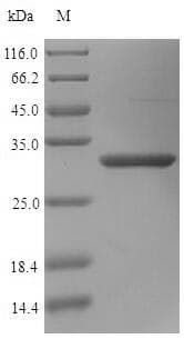 Human Osteoglycin / Mimecan Protein (Recombinant 6His, N-terminus)