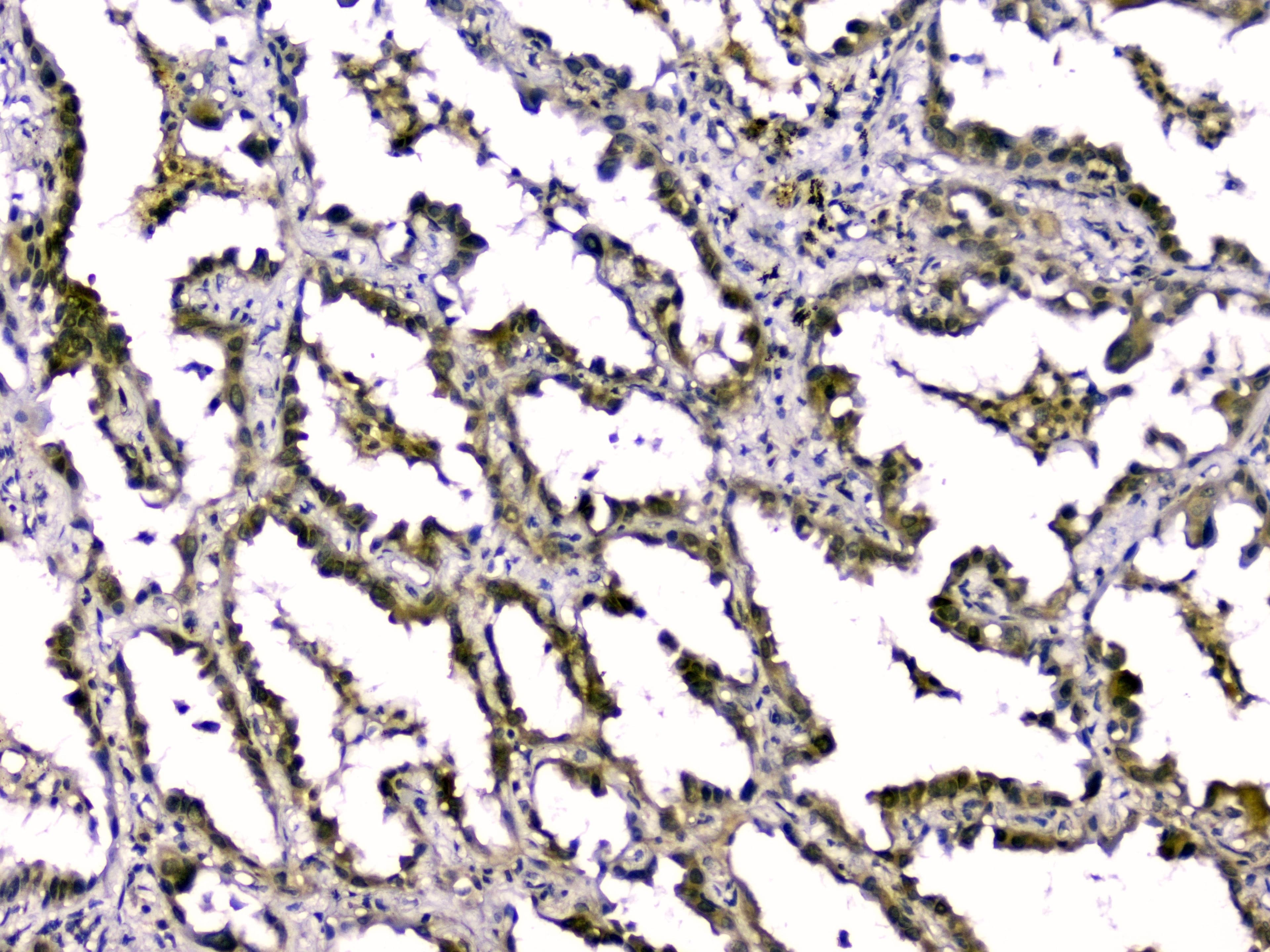 Polyclonal Rabbit anti-Human TGFB2 / TGF Beta2 Antibody (WB)