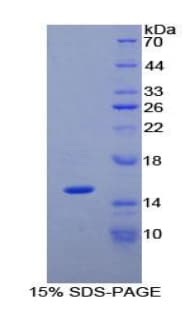 Human PLAA Protein (Recombinant His)