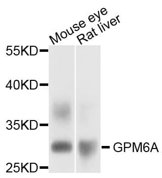 GPM6A / Glycoprotein M6A Antibody