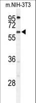 Polyclonal Rabbit anti-Human TMEM108 Antibody (aa524-553, WB)