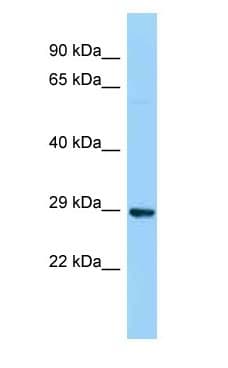 DERA Antibody (aa39-88)