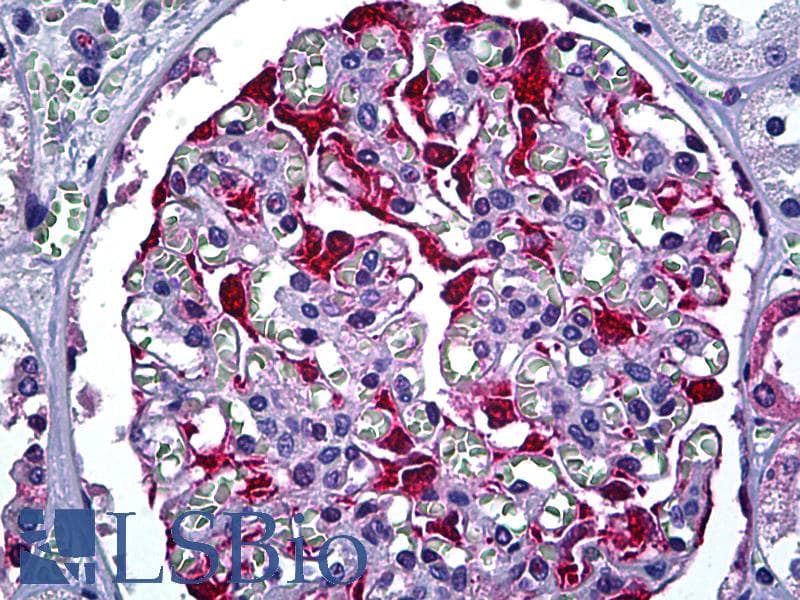 PathPlus™ S100A6 / Calcyclin Antibody (clone 6B5)