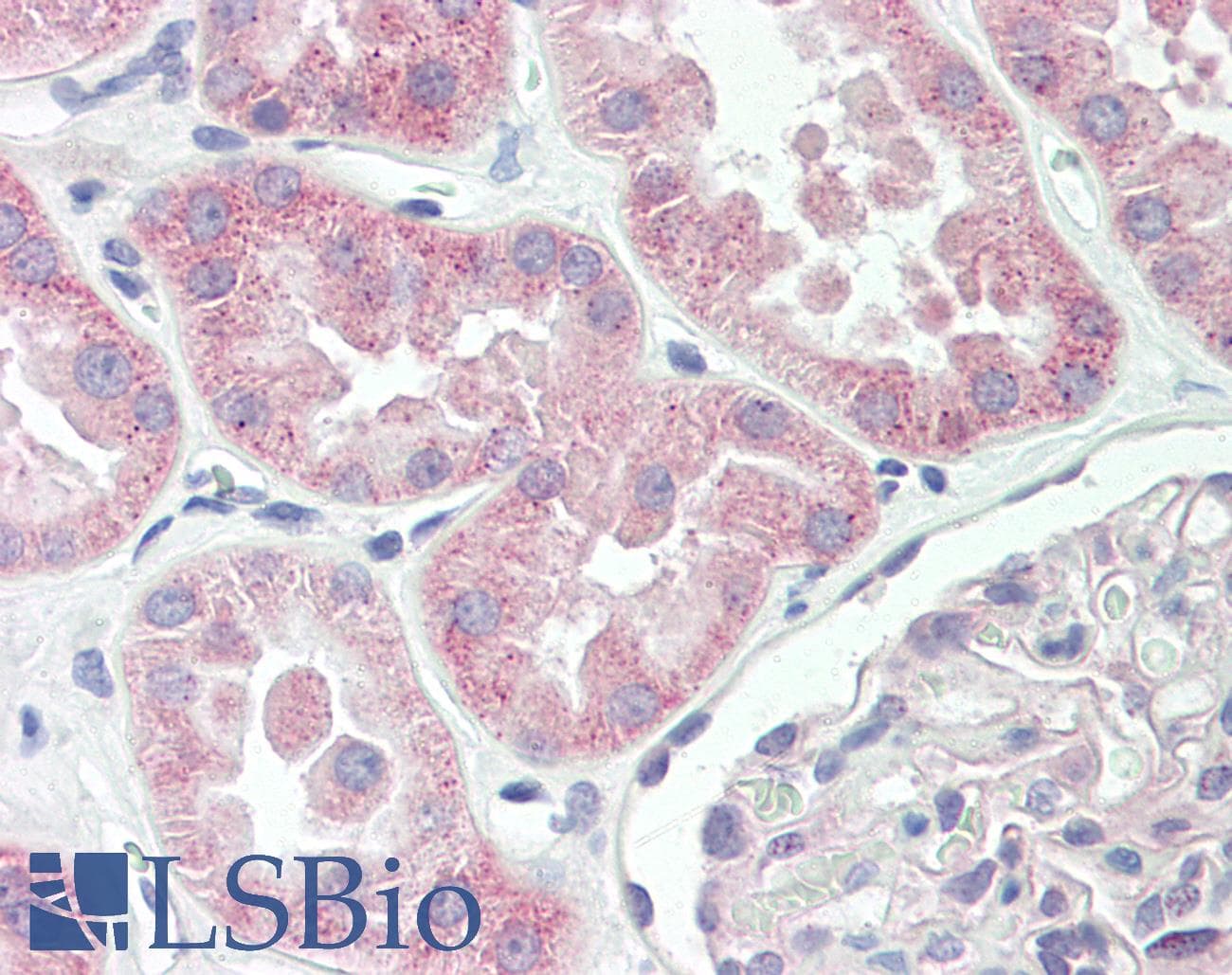 IHC-plus™ SPTBN5 Antibody (aa481-530)
