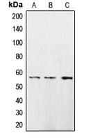 CAMK2D / CaMKII Delta Antibody (Internal)
